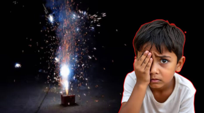 দীপাবলিতে আতশবাজির আগুনে শিশুর চোখে গুরুতর আঘাত