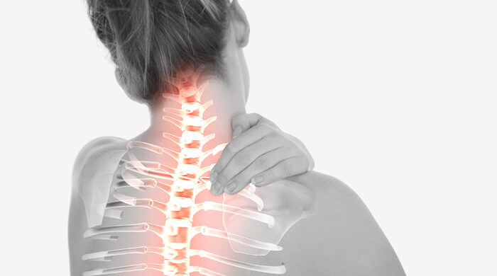 ঘাড়ব্যথার নীরব ঘাতক সারভাইক্যাল মাইলোপ্যাথি