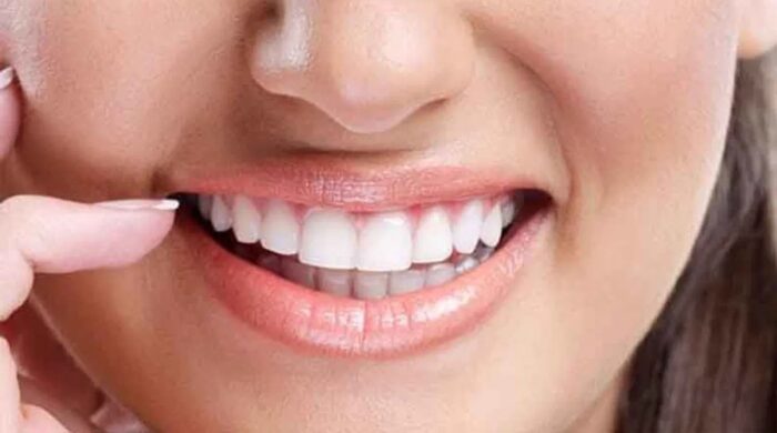 দাঁতের এনামেল ক্ষয় প্রতিরোধ