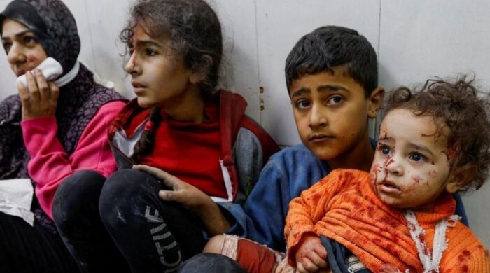 মধ্যপ্রাচ্যের সংঘাতে শিশু নিহত আহত