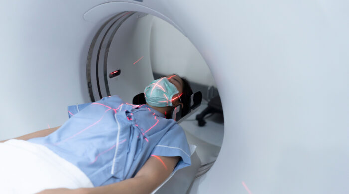 হেড ও নেক ক্যানসারে রেডিওথেরাপির অগ্রগতি