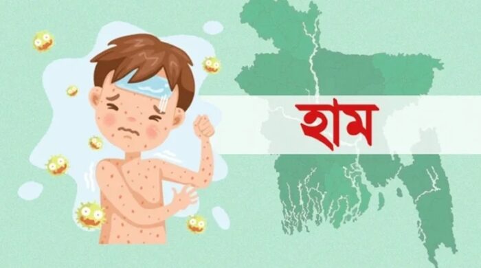 হাম ও হামের উপসর্গে প্রাণ গেল আরও ৯ শিশুর
