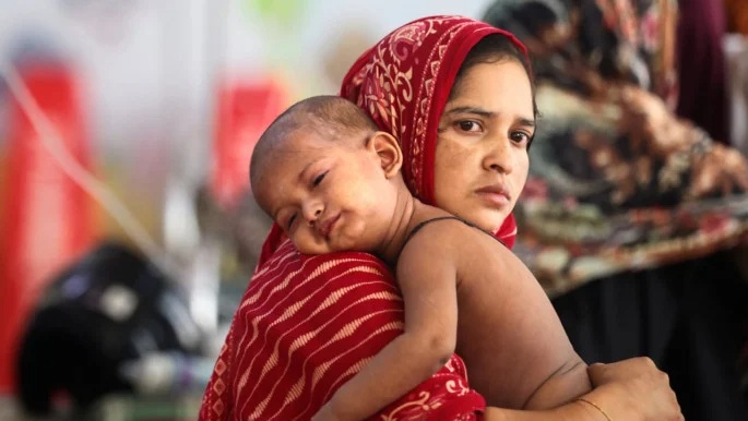 আবহাওয়ায় বাড়ছে হাম সংক্রমণ