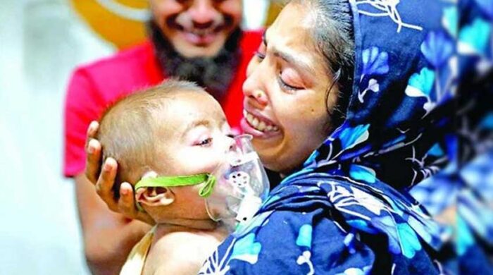 হাম ও উপসর্গ নিয়ে ১২ শিশুর মৃত্যু